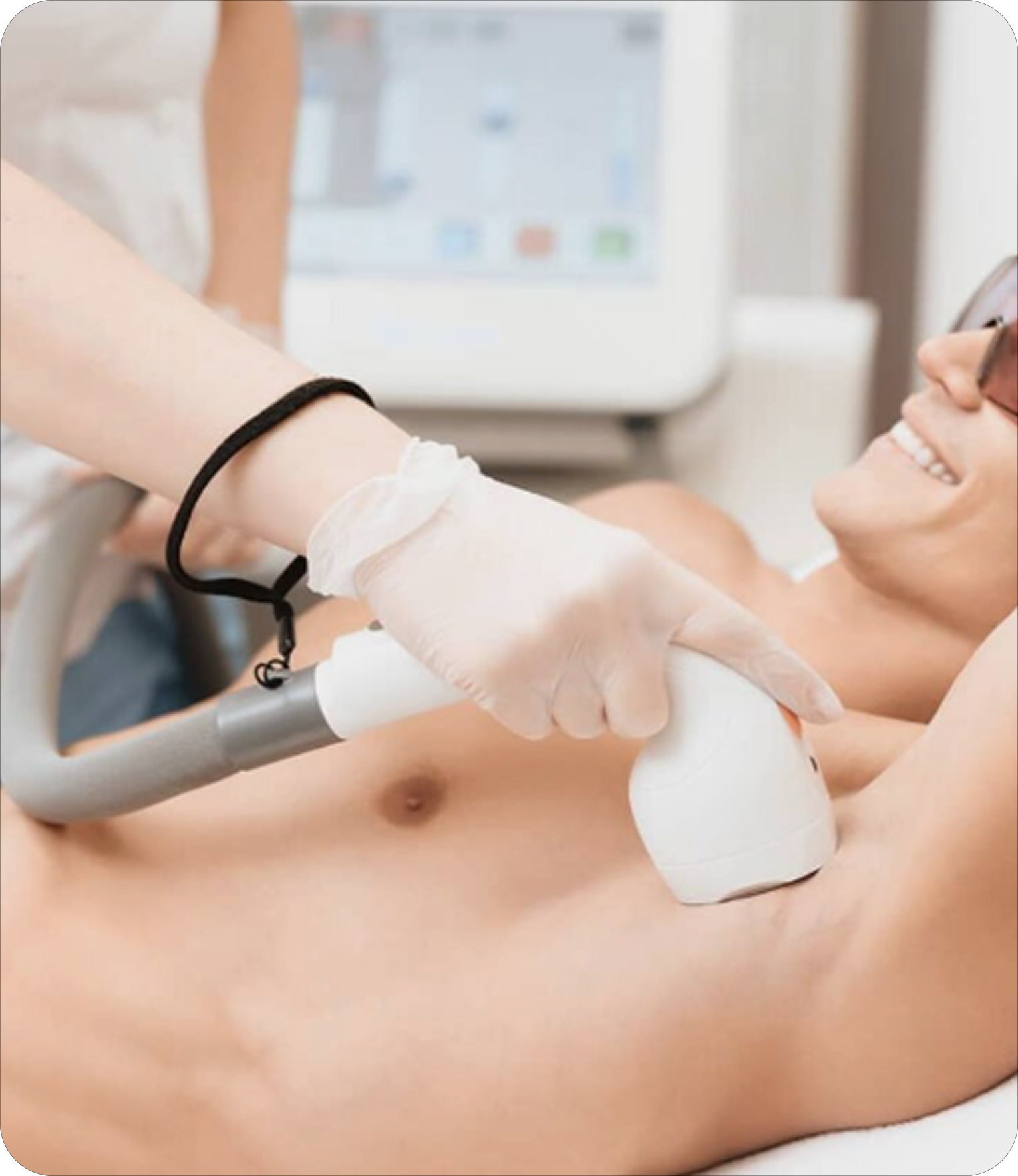 Laser Hair Removal